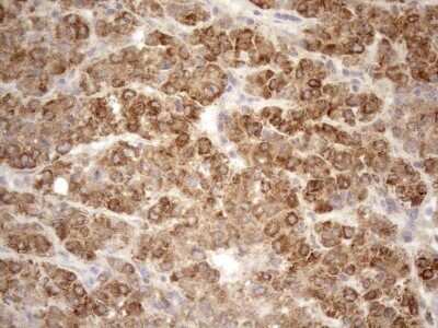 Immunohistochemistry: 5'-Nucleotidase/CD73 Antibody (OTI1G2) - Azide and BSA Free [NBP2-71214]