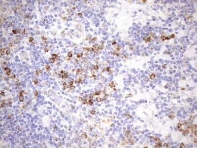 Immunohistochemistry: 5'-Nucleotidase/CD73 Antibody (OTI1G2) - Azide and BSA Free [NBP2-71214]