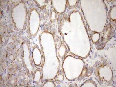 Immunohistochemistry: 5'-Nucleotidase/CD73 Antibody (OTI1G2) - Azide and BSA Free [NBP2-71214]
