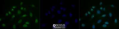 Immunocytochemistry/ Immunofluorescence: 53BP1 Antibody - BSA Free [NB100-904]