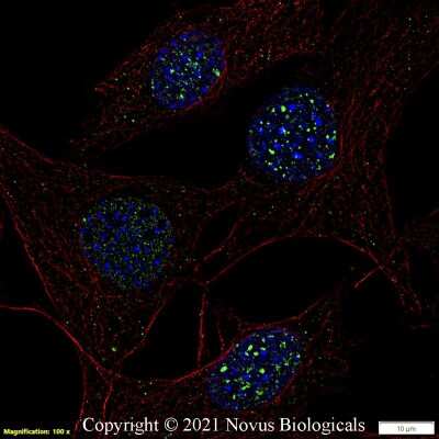 Immunocytochemistry/ Immunofluorescence: 53BP1 Antibody - BSA Free [NB100-904]