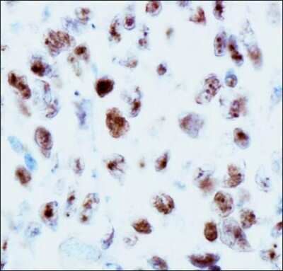 Immunohistochemistry: 53BP1 Antibody - BSA Free [NB100-904]