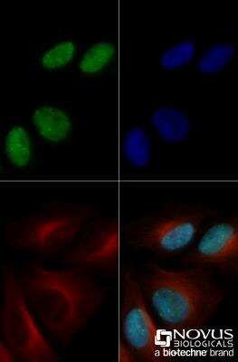 Immunocytochemistry/ Immunofluorescence: 53BP1 Antibody (1285C) - BSA Free [NBP2-54753]