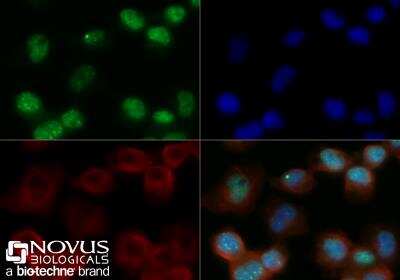 Immunocytochemistry/ Immunofluorescence: 53BP1 Antibody (1285C) - BSA Free [NBP2-54753]