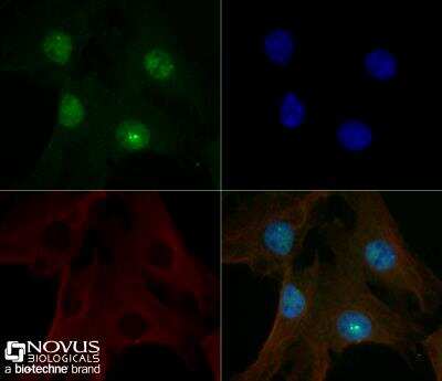 Immunocytochemistry/ Immunofluorescence: 53BP1 Antibody (1285C) - BSA Free [NBP2-54753]