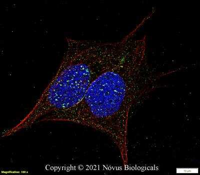 Immunocytochemistry/ Immunofluorescence: 53BP1 Antibody (1285C) - BSA Free [NBP2-54753]