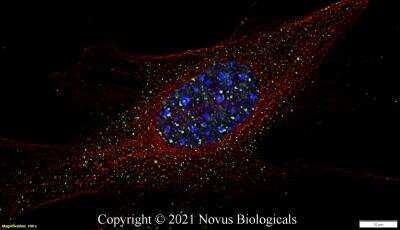 Immunocytochemistry/ Immunofluorescence: 53BP1 Antibody (1285C) - BSA Free [NBP2-54753]