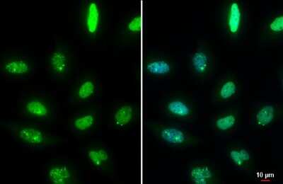 Immunocytochemistry/ Immunofluorescence: 53BP1 Antibody (HL275) [NBP3-13664]