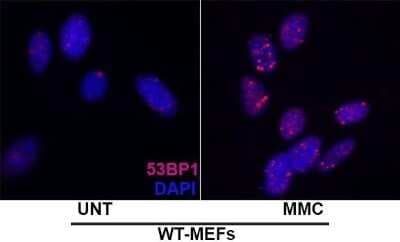 Immunocytochemistry/Immunofluorescence Staining of 53BP1 in Embryonic Fibroblast Cells