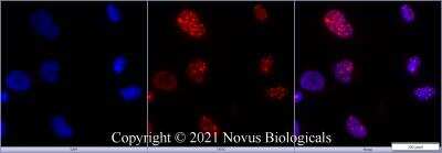 Immunocytochemistry/Immunofluorescence Staining of 53BP1 in HeLa Cells