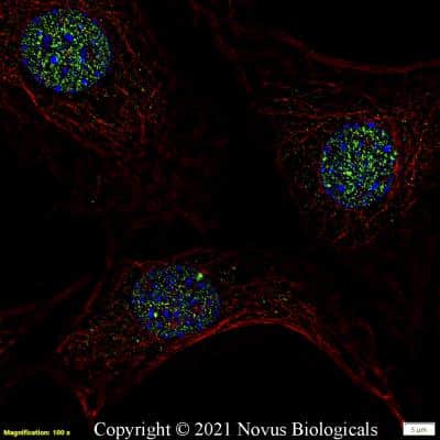 Immunocytochemistry/ Immunofluorescence: 53BP1 Antibody - BSA Free [NB100-305]