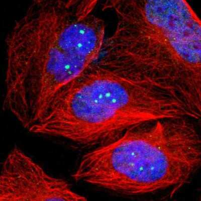 Immunocytochemistry/ Immunofluorescence: 53BP1 Antibody [NBP2-54659]