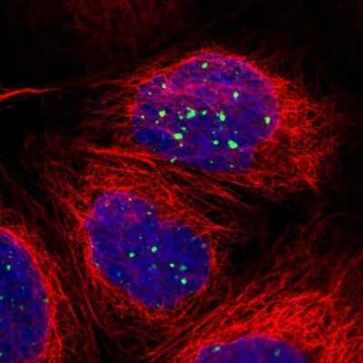 Immunocytochemistry/ Immunofluorescence: 53BP1 Antibody [NBP2-54677]
