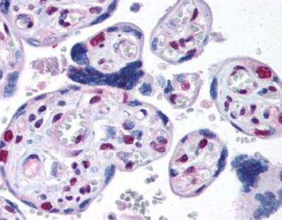 Immunohistochemistry: 53BP1 Antibody - BSA Free [NB100-305]