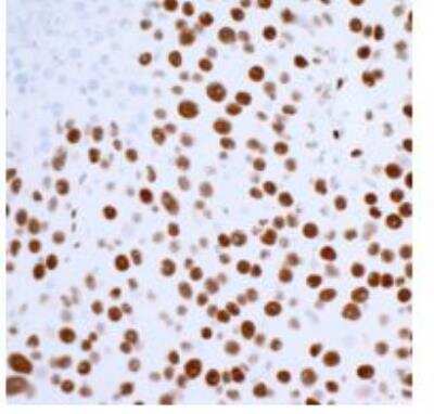 Immunohistochemistry: 53BP1 Antibody (BL-250-1H11) [NBP3-14667]