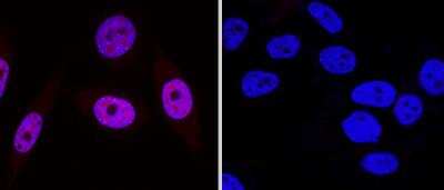 Knockout Validation of 53BP1 Antibody in HeLa and 53BP1 Knockout HeLa Cells in Immunocytochemistry/Immunofluorescence