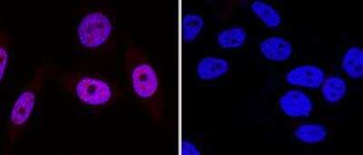 Knockout Validated: 53BP1 Antibody Pack [NB100-926]