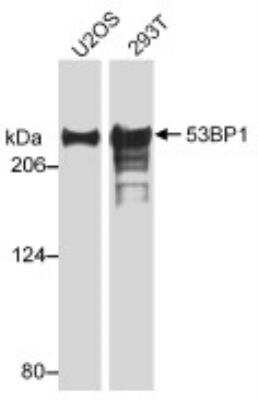 Western Blot of 53BP1 in Multiple Cell Lines