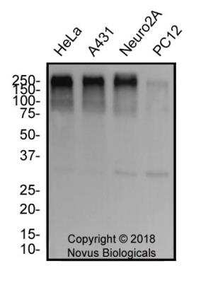 Western Blotting of 53BP1 in Multiple Cell Lines