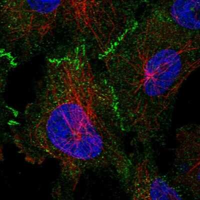Immunocytochemistry/ Immunofluorescence: 53BP2 Antibody [NBP2-58677]