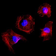 Applications in HeLa Cells for Phalloidin-TRITC