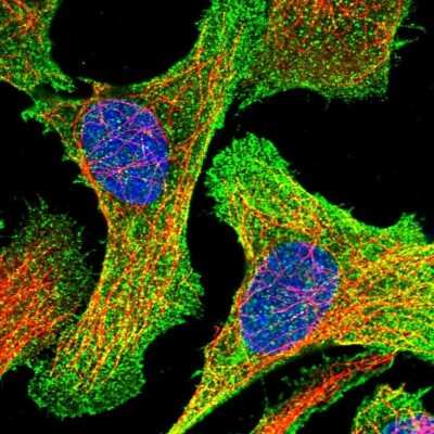 Immunocytochemistry/ Immunofluorescence: 58K Golgi Protein Antibody [NBP2-48601]