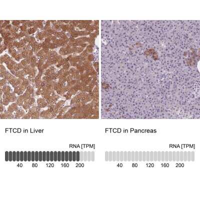 Immunohistochemistry-Paraffin: 58K Golgi Protein Antibody [NBP2-48600]