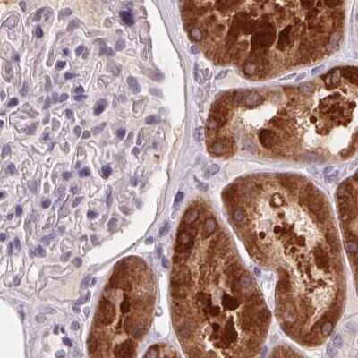 Immunohistochemistry-Paraffin: 58K Golgi Protein Antibody [NBP2-48600]