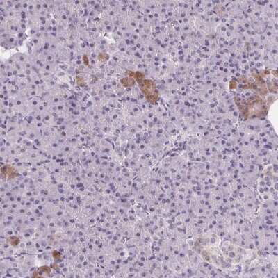 Immunohistochemistry-Paraffin: 58K Golgi Protein Antibody [NBP2-48601]