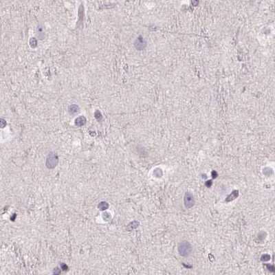 Immunohistochemistry-Paraffin: 58K Golgi Protein Antibody [NBP2-48601]