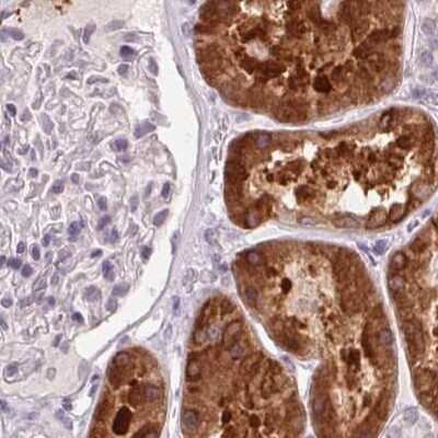 Immunohistochemistry-Paraffin: 58K Golgi Protein Antibody [NBP2-48601]