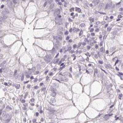 Immunohistochemistry-Paraffin: 58K Golgi Protein Antibody [NBP2-48601]