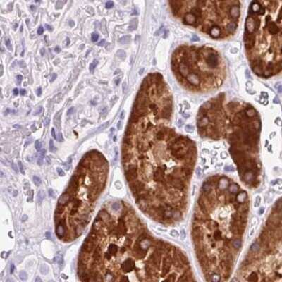 Immunohistochemistry-Paraffin: 58K Golgi Protein Antibody [NBP2-48651]