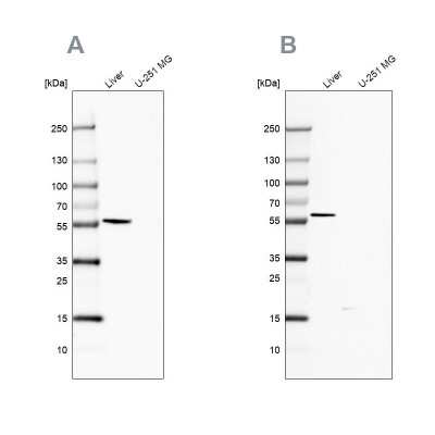 Western Blot: 58K Golgi Protein Antibody [NBP2-48601]