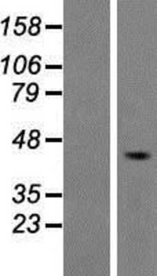 Western Blot: 5-HT4 Overexpression Lysate [NBP2-04614]