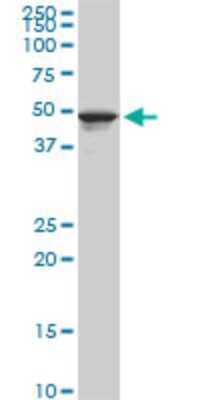Western Blot: 5T4 Antibody (1B6) [H00007162-M09]