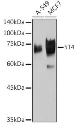 Western Blot: 5T4 Antibody (2K10S6) [NBP3-15764]