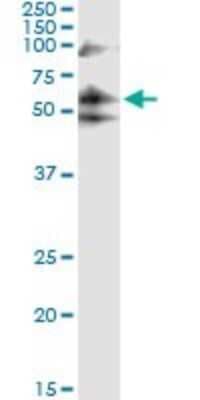 Western Blot: 6 Phosphofructo 2 Kinase Antibody (3F3) [H00005209-M08]