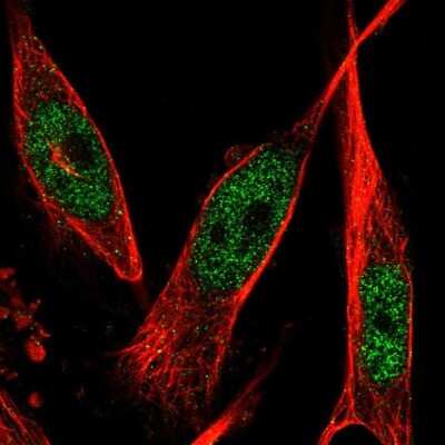 Immunocytochemistry/ Immunofluorescence: 6 Phosphofructo 2 Kinase Antibody [NBP1-87478]