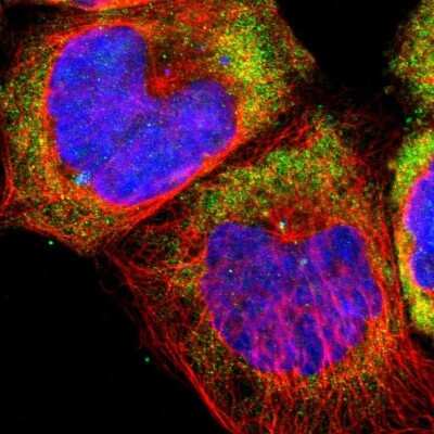 Immunocytochemistry/ Immunofluorescence: 60S ribosomal protein L23 Antibody [NBP1-87847]