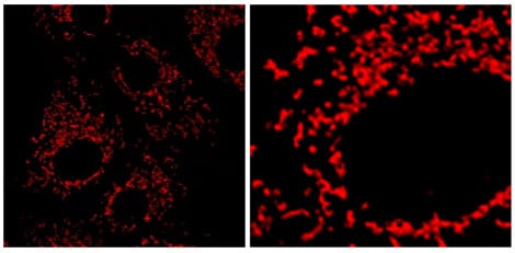 Applications on Mitochondria for Janelia Fluor® 635, NHS ester