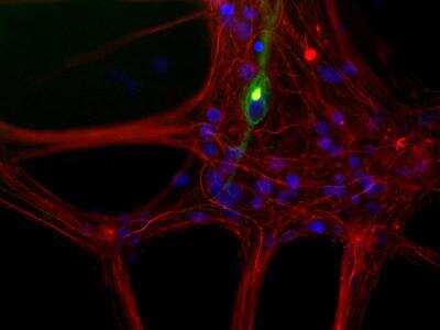 Immunocytochemistry/ Immunofluorescence: NF-L Antibody [NB300-131]