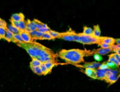 Immunocytochemistry/ Immunofluorescence: 7-Ketocholesterol Antibody (7E1) [NBP2-59356]