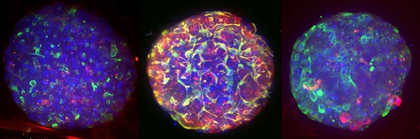 Tissue Clearing Pro-Organoid Applications