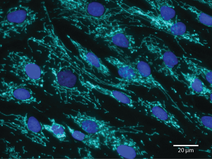 High resolution confocal image of MitoBrillant 646 shows the morphology of mitochondria in fixed-cells