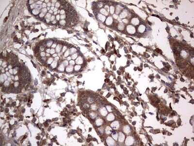 Immunohistochemistry: A-RAF Antibody (OTI2G9) [NBP2-46538]