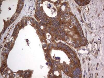 Immunohistochemistry: A-RAF Antibody (OTI2G9) [NBP2-46538]