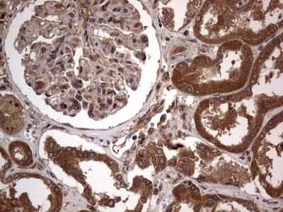 Immunohistochemistry: A-RAF Antibody (OTI2G9) [NBP2-46538]