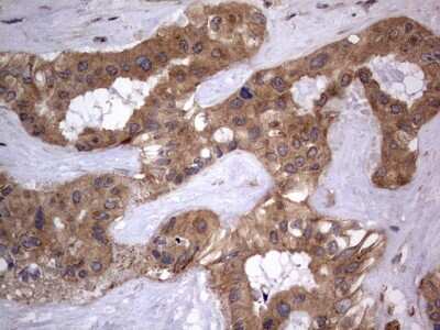 Immunohistochemistry: A-RAF Antibody (OTI2G9) [NBP2-46538]