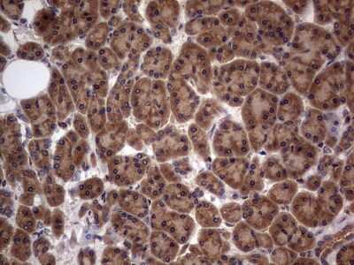 Immunohistochemistry: A-RAF Antibody (OTI2G9) [NBP2-46538]